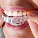 invisalign Agoura Hills
